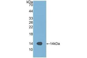 Detection of Recombinant ALT, Human using Polyclonal Antibody to Alanine Aminotransferase (ALT)