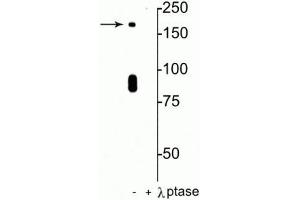 Western blot of rat hippocampal lysate showing specific immunolabeling of the ~180 kDa NR2B subunit of the NMDAR phosphorylated at in the first lane (-). (GRIN2B anticorps  (pSer1480))
