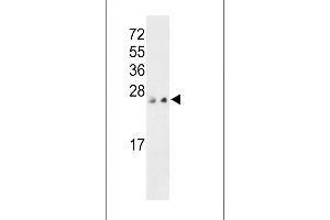 Western blot analysis of PTP4A3 C-term (ABIN392855 and ABIN2842273) in MCF-7 and 293 cell line lysates (35 μg/lane). (PTP4A3 anticorps  (C-Term))
