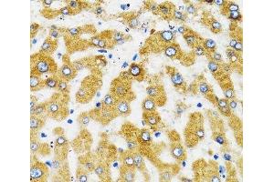 Immunohistochemistry of paraffin-embedded Human liver using SLC27A2 Polyclonal Antibody at dilution of 1:100 (40x lens).