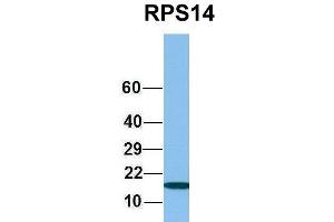 Host:  Rabbit  Target Name:  RPS14  Sample Type:  721_B  Antibody Dilution:  1.