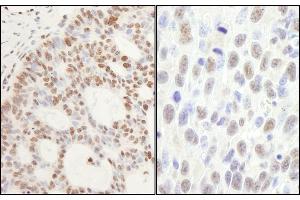 anti-Protein Phosphatase, Mg2+/Mn2+ Dependent, 1G (PPM1G) (AA 400-450) antibody