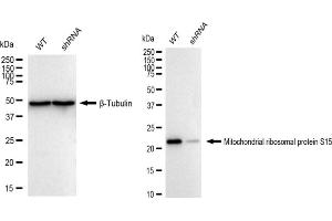 Western blotting analysis using Mitochondrial ribosomal protein S15 antibody (ABIN7799432). (Recombinant MRPS15 anticorps)