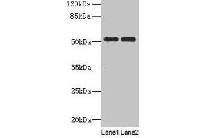 Western blot All lanes: PAH antibody at 2. (Phenylalanine Hydroxylase anticorps  (AA 2-452))