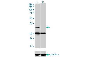 Western blot analysis of STAR over-expressed 293 cell line, cotransfected with STAR Validated Chimera RNAi (Lane 2) or non-transfected control (Lane 1). (STAR anticorps  (AA 81-180))