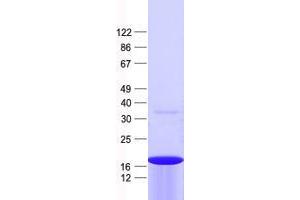 Validation with Western Blot