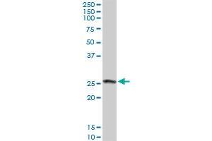 CLIC3 MaxPab rabbit polyclonal antibody. (CLIC3 anticorps  (AA 1-236))