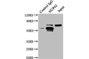 Immunoprecipitating NUP62 in A549 whole cell lysate Lane 1: Rabbit control IgG instead of ABIN7161836 in A549 whole cell lysate. (NUP62 anticorps  (AA 173-522))