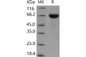 Western Blotting (WB) image for Tumor-Associated Calcium Signal Transducer 2 (TACSTD2) (Active) protein (Fc Tag) (ABIN7198526)