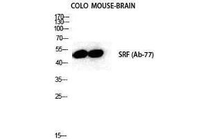Western Blotting (WB) image for anti-Serum Response Factor (SRF) (Tyr1197) antibody (ABIN3180896) (SRF anticorps  (Tyr1197))