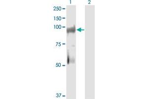 Western Blot analysis of KSR2 expression in transfected 293T cell line by KSR2 monoclonal antibody (M08), clone 1G4.