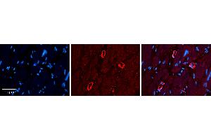 Rabbit Anti-GRP78 Antibody   Formalin Fixed Paraffin Embedded Tissue: Human heart Tissue Observed Staining: Cytoplasmic Primary Antibody Concentration: 1:100 Other Working Concentrations: 1:600 Secondary Antibody: Donkey anti-Rabbit-Cy3 Secondary Antibody Concentration: 1:200 Magnification: 20X Exposure Time: 0. (GRP78 anticorps  (C-Term))