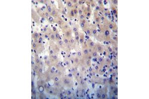 HPRT1 Antibody (N-term) (ABIN652234 and ABIN2840981) immunohistochemistry analysis in formalin fixed and paraffin embedded human liver tissue followed by peroxidase conjugation of the secondary antibody and DAB staining. (HPRT1 anticorps  (N-Term))