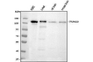 Western blot analysis of TIF1 gamma using anti-TIF1 gamma antibody (ABIN3043492).