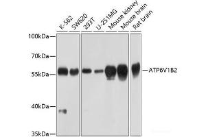Western blot analysis of extracts of various cell lines using ATP6V1B2 Polyclonal Antibody at dilution of 1:1000. (ATP6V1B2 anticorps)