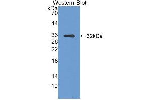Detection of recombinant SPR using Polyclonal Antibody to Sepiapterin Reductase (SPR) (SPR anticorps  (AA 1-261))