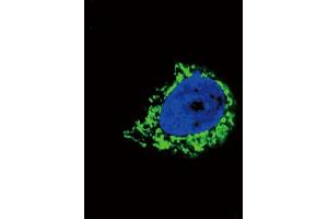Immunofluorescence (IF) image for anti-Insulin-Like Growth Factor Binding Protein 2, 36kDa (IGFBP2) antibody (ABIN3003819) (IGFBP2 anticorps)