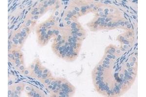 Detection of MST1R in Mouse Oviduct Tissue using Polyclonal Antibody to Macrophage Stimulating 1 Receptor (MST1R)