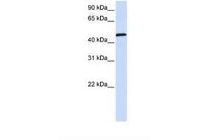 Image no. 1 for anti-Uridine Monophosphate Synthetase (UMPS) (AA 398-447) antibody (ABIN6738421)