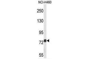 Western blot analysis of CHAT Antibody (N-term) in NCI-H460 cell line lysates (35µg/lane). (Choline Acetyltransferase anticorps  (N-Term))