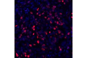 Immunofluorescence (IF) image for anti-Antigen Identified By Monoclonal Antibody Ki-67 (MKI67) (AA 1200-1250) antibody (ABIN7448915) (Recombinant Ki-67 anticorps  (AA 1200-1250))