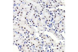 Immunohistochemistry of paraffin-embedded mouse kidney using SP1 antibody (ABIN7270505) at dilution of 1:100 (40x lens).