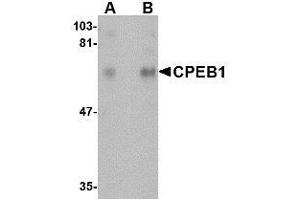 Western blot analysis of CPEB1 in rat brain tissue lysate with AP30241PU-N CPEB1 antibody at (A) 1 and (B) 2 μg/ml. (CPEB1 anticorps  (N-Term))