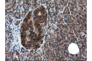 Image no. 2 for anti-CCR4-NOT Transcription Complex Subunit 4 (CNOT4) (AA 190-455) antibody (ABIN1491098) (CNOT4 anticorps  (AA 190-455))