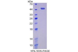 SDS-PAGE analysis of Human Pim-1 Oncogene Protein. (PIM1 Protéine)