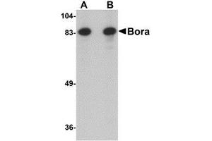 Western blot analysis of Bora in Jurkat cell lysate with AP30162PU-N Bora antibody at (A) 1 and (B) 2 μg/ml.