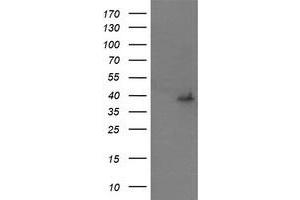 Image no. 2 for anti-Mitogen-Activated Protein Kinase Kinase 3 (MAP2K3) antibody (ABIN1499397)