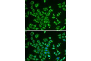 Immunofluorescence analysis of HeLa cells using SMAD1 antibody. (SMAD1 anticorps)