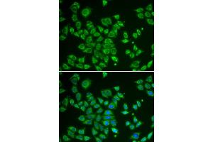 Immunofluorescence analysis of HeLa cells using SMAD1 antibody. (SMAD1 anticorps)