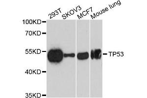 Western blot analysis of extracts of various cells, using TP53 antibody. (p53 anticorps)