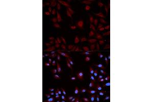 Immunofluorescence analysis of HeLa cell using STAT5B antibody. (STAT5B anticorps  (AA 40-280))