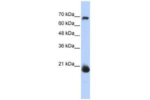 CHCHD4 antibody used at 1 ug/ml to detect target protein.