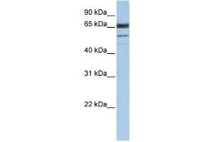 WB Suggested Anti-SEPN1 Antibody Titration:  1 ug/ml  Positive Control:  Hela cell lysate (SEPN1 anticorps  (C-Term))