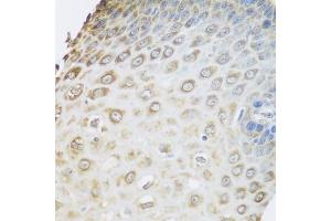 Immunohistochemistry of paraffin-embedded human esophagus using GRPEL2 antibody.