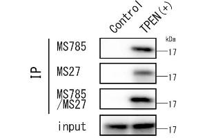 Detection of endogenous SOD1 wild type under ER-stress HEK293 cells were cultured in the presence and absence of 10 M TPEN, a potent zinc-specific chelator, for 8 hours. (SOD1 anticorps  (ALS-related mutants))