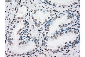 Image no. 9 for anti-Polo-Like Kinase 1 (PLK1) antibody (ABIN1500282)