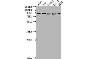 Western Blot Positive WB detected in: 293T whole cell lysate, 293 whole cell lysate, HepG2 whole cell lysate, THP-1 whole cell lysate, U251 whole cell lysate All lanes: CCHCR1 antibody at 1:2000 Secondary Goat polyclonal to rabbit IgG at 1/50000 dilution Predicted band size: 89, 100, 96 kDa Observed band size: 89 kDa