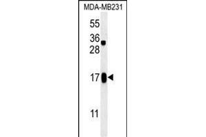 C4orf34 Antibody (C-term) (ABIN651629 and ABIN2840335) western blot analysis in MDA-M cell line lysates (35 μg/lane). (SMIM14 anticorps  (C-Term))