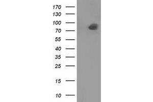Western Blotting (WB) image for anti-Protein tyrosine Phosphatase, Receptor Type, E (PTPRE) antibody (ABIN1500508) (PTPRE anticorps)