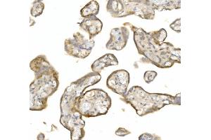 anti-Lymphocyte Antigen 6 Complex, Locus E (LY6E) (AA 21-101) antibody