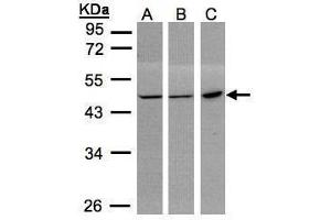 WB Image Sample(30 ug whole cell lysate) A:293T B:MOLT4 , C:Raji , 10% SDS PAGE antibody diluted at 1:1000