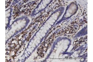 Immunoperoxidase of monoclonal antibody to AKR1B1 on formalin-fixed paraffin-embedded human small Intestine. (AKR1B1 anticorps  (AA 1-316))