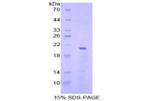 SDS-PAGE (SDS) image for Von Willebrand Factor (VWF) (AA 1167-1334) protein (His tag) (ABIN1877458)