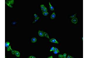 Immunofluorescent analysis of HepG2 cells using ABIN7158656 at dilution of 1:100 and Alexa Fluor 488-congugated AffiniPure Goat Anti-Rabbit IgG(H+L) (LEF1 anticorps  (AA 75-216))
