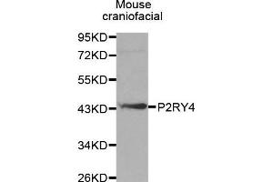 Western Blotting (WB) image for anti-Pyrimidinergic Receptor P2Y, G-Protein Coupled, 4 (P2RY4) (AA 286-365) antibody (ABIN3017282) (P2RY4 anticorps  (AA 286-365))