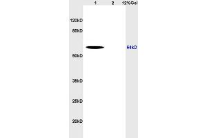 Lane 1: human colon carcinoma lysates Lane 2: rat brain lysates probed with Anti CD166 Polyclonal Antibody, Unconjugated (ABIN673944) at 1:200 in 4 °C. (CD166 anticorps  (AA 451-583))